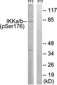 IKK-alpha/beta (phospho-Ser176/177) antibody
