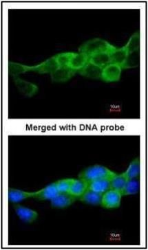 IKK beta antibody