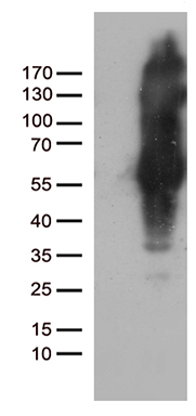 IKK gamma (IKBKG) antibody