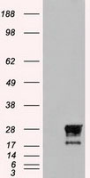 IKK gamma (IKBKG) antibody