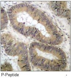 IKK α (Phospho-Thr23) Antibody