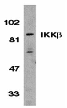 IKK beta Antibody