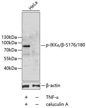 IKKalpha/beta (Phospho-S176/180) antibody