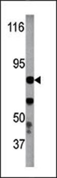 IKKb (phospho-Tyr199) antibody