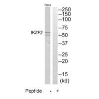 IKZF2 antibody