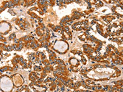 IKZF3 Antibody
