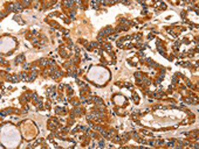 IKZF3 antibody