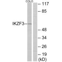 IKZF3 antibody