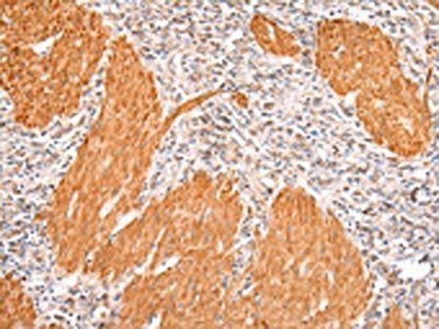 IKZF4 Antibody