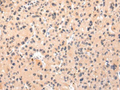 IKZF4 Antibody
