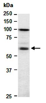 IKZF4 antibody