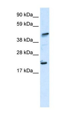 IKZF5 antibody