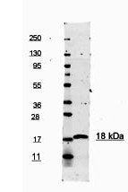 IL-1 beta antibody (Peroxidase)