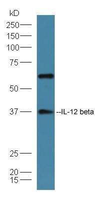 IL-12 beta antibody