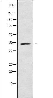 IL-13 R alpha1 antibody