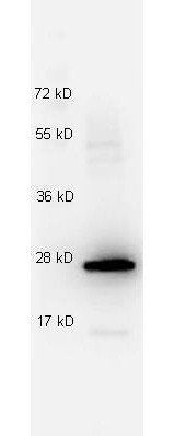 IL-27/P28 antibody