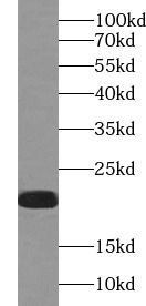 IL-36 gamma antibody