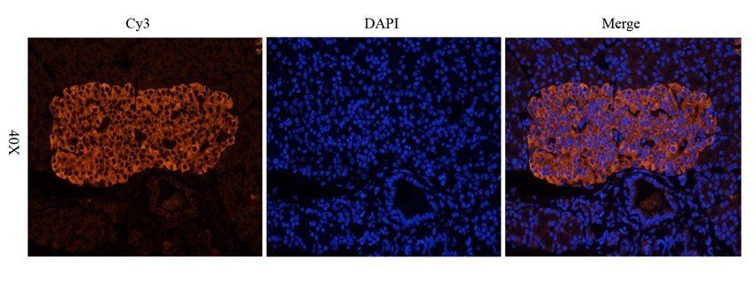 IL1 beta antibody