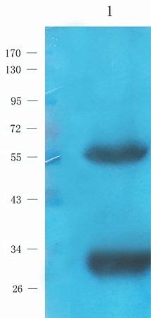 IL1 beta antibody