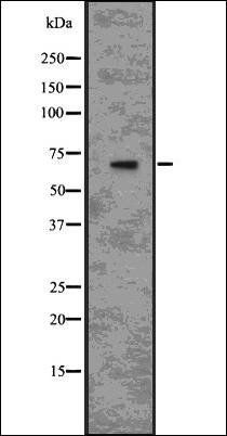 IL1 Receptor antibody