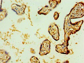 IL1R1 Antibody