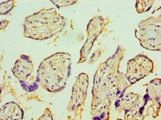 IL1R1 Antibody