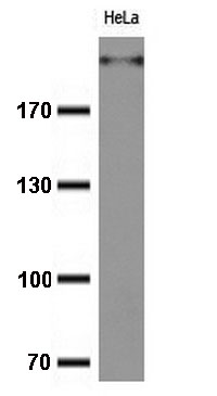 IL10RA antibody