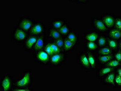 IL10RA antibody