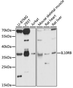 IL10RB antibody