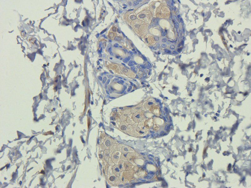 IL11 antibody