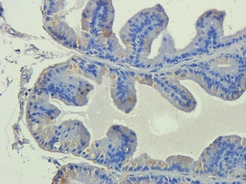 IL11 Rabbit Polyclonal Antibody