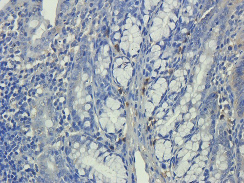 IL11 Rabbit Polyclonal Antibody