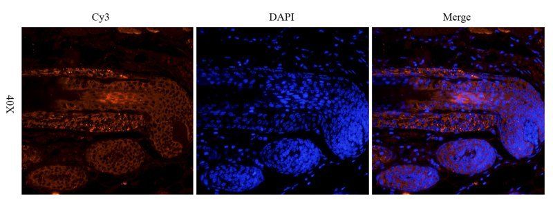IL11 Rabbit Polyclonal Antibody