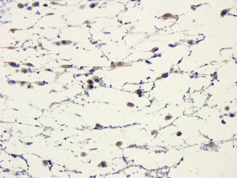 IL11 Rabbit Polyclonal Antibody