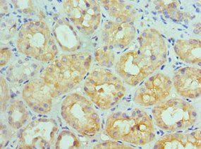 IL11RA Antibody