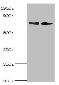 IL12 p40 antibody