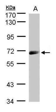 IL12 Receptor beta1 antibody