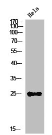 IL12A Antibody