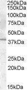 Goat anti-Il12b / Il12p40 (mouse) Antibody