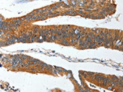 IL12RB1 Antibody