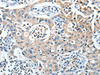 IL12RB1 Antibody