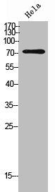 IL12RB1 antibody