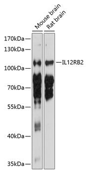 IL12RB2 antibody