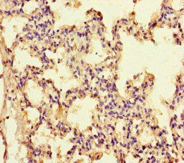 IL13 Antibody