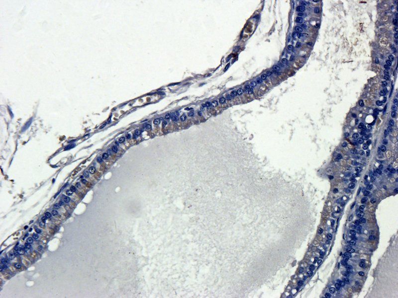 IL13 Rabbit Polyclonal Antibody