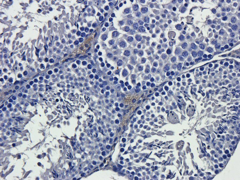 IL13 Rabbit Polyclonal Antibody