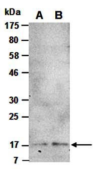 IL-13 (C) Antibody, Rabbit Polyclonal