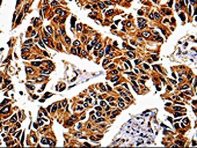 IL13RA1 Antibody