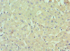 IL13RA2 Antibody