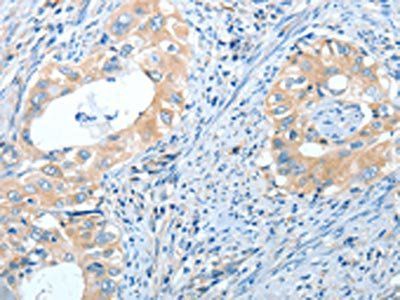 IL13RA2 Antibody